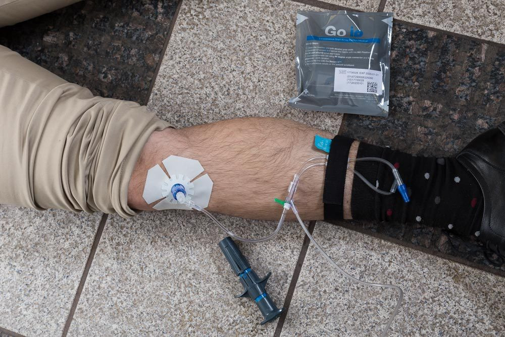 Iofix NIO Intraosseous Devices - Adult