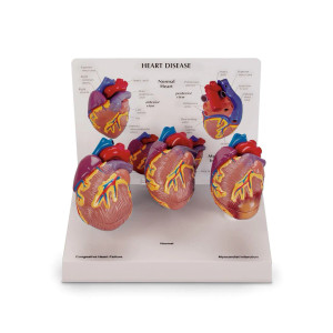 3-Piece Mini Heart Set Models