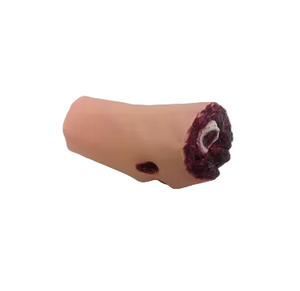 Nasco Leg Amputation