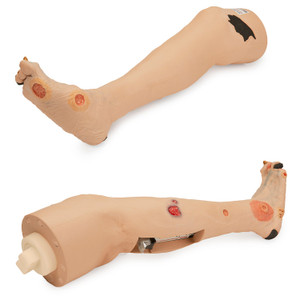 Nasco Annie Arterial Insufficiency Leg