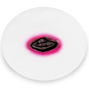 Nasco Anthrax, Oblong-Shaped Wound