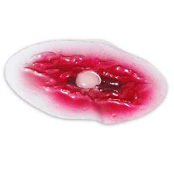 Nasco Bladder Wound