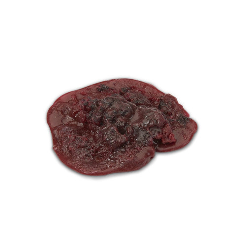 Life/form® Medium Blood Clot