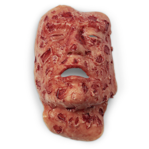 Nasco Wound – Face Burn