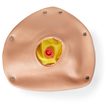 Nasco Pregnant Overlay with Fetus – Light