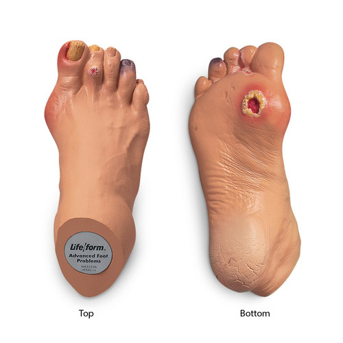 Nasco Advanced Foot Problems