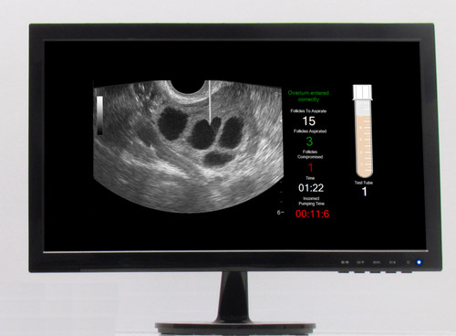 Nasco SonoHysteroSim LCD Monitor – SHSMON
