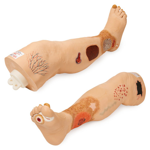 Nasco "Vinnie" Venous Insufficiency Leg
