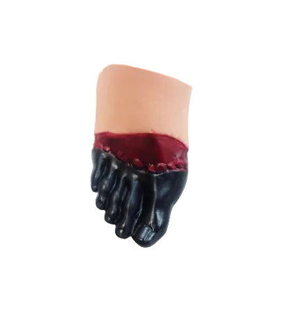 Nasco Frostbite Foot