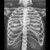 Nasco X-Ray Radiographic Positioning Manikin