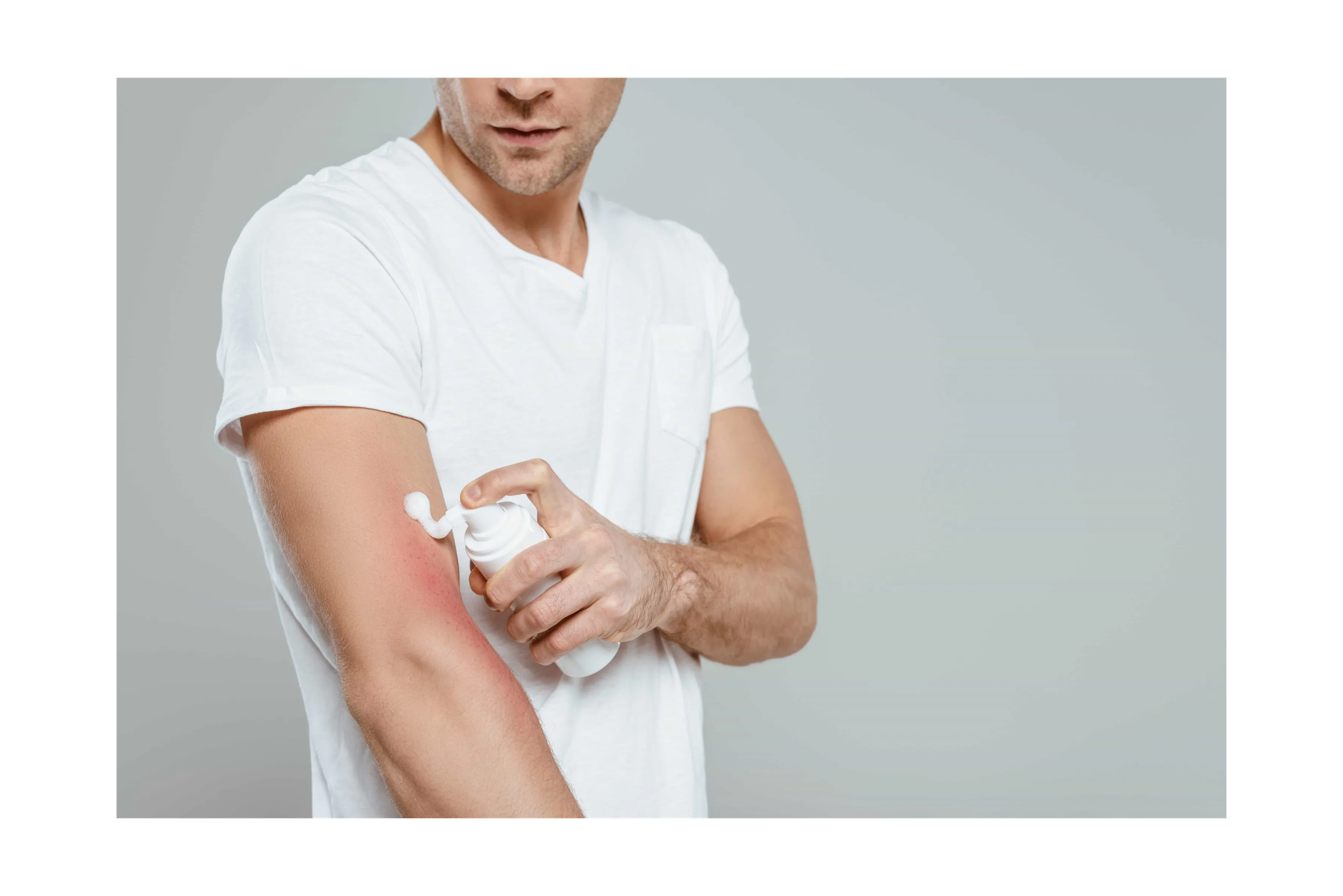 Manage Eczema Naturally With An Infrared Sauna JNH Lifestyles