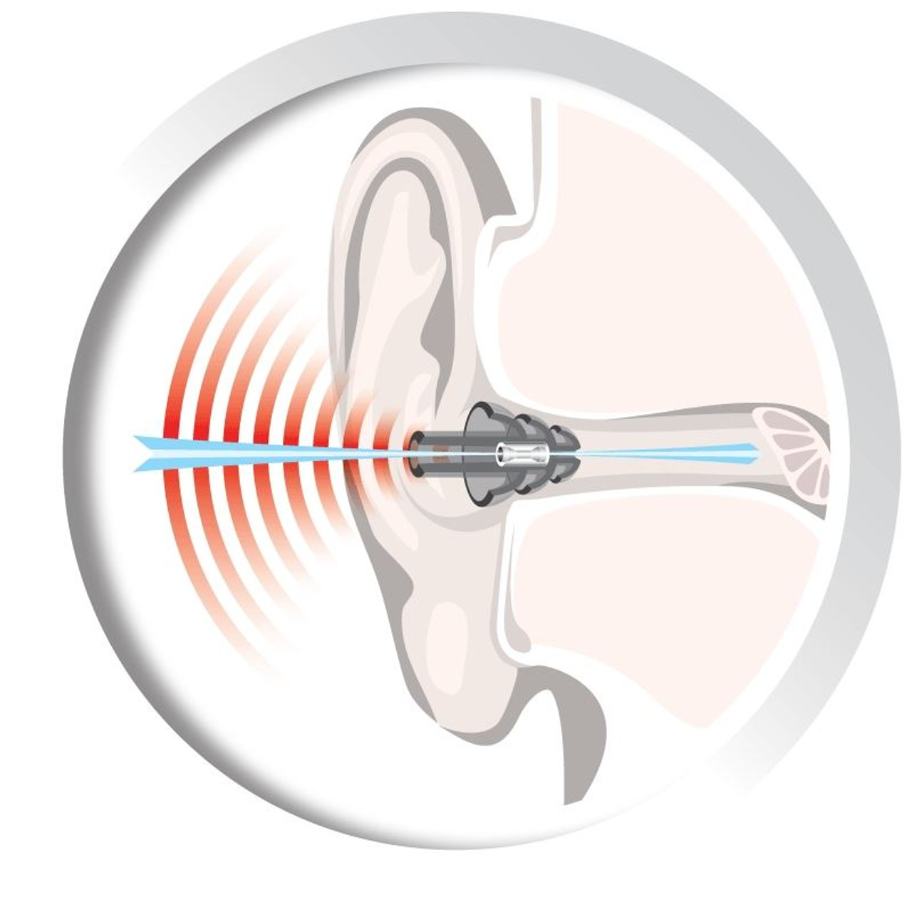 Auritech Shooting Ear Plugs with hearing valve