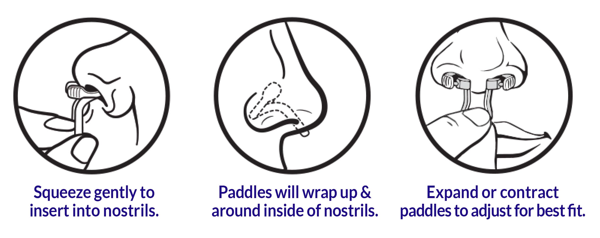 Mute AntiSnoring Device Sleep Without Snoring