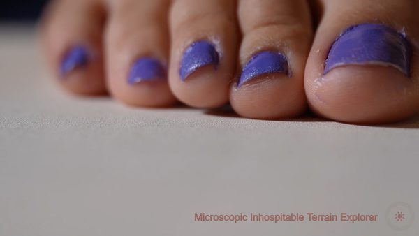 Microscopic Inhospitable Terrain Explorer