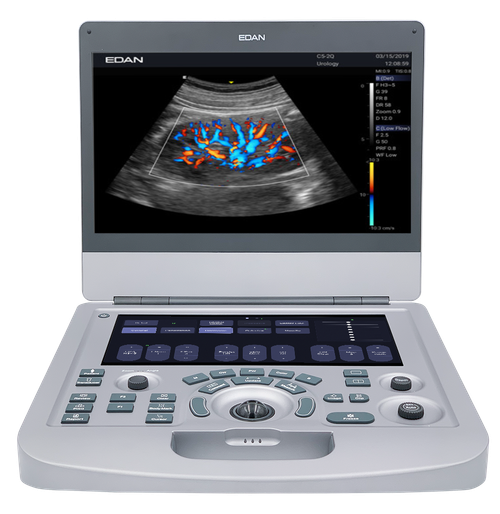 Acclarix AX3 Diagnostic Ultrasound System without probe