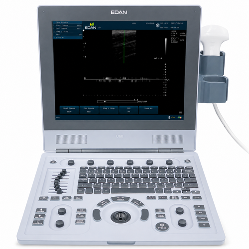 U60 Diagnostic Ultrasound System with carrying bag and battery