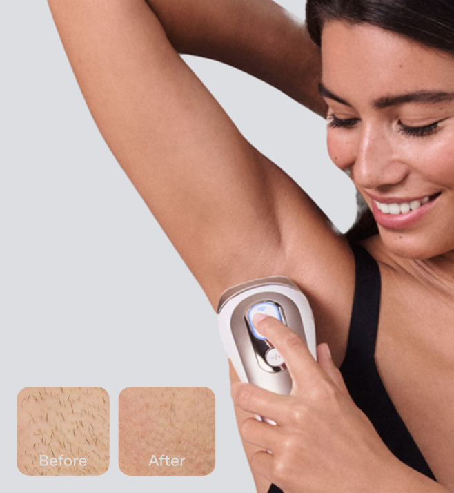 IPLs | Intense Pulse Light Hair Removal Gifts | Braun IPLs | Intense Pulse Light Hair Removal Gifts | Braun
