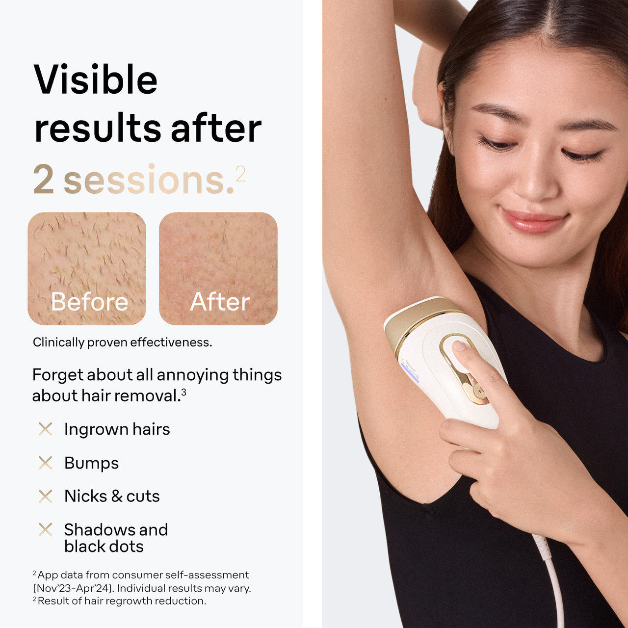 Braun Smart IPL: At Home Alternative to Laser Hair Removal
