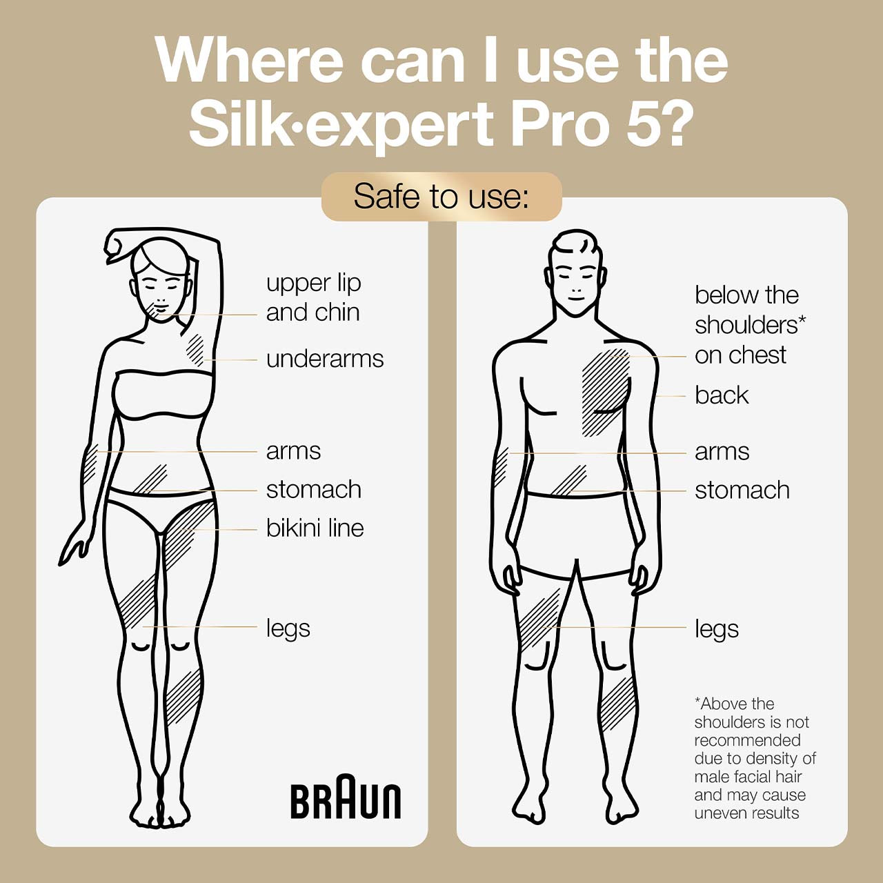 Braun IPL Silk Expert Pro 5 Visible Permanent Hair Removal for Men and  Women, with Premium Pouch and Venus Razor, Alternative to Laser Hair  Removal, PL5014, White/Gold : : Health & Personal