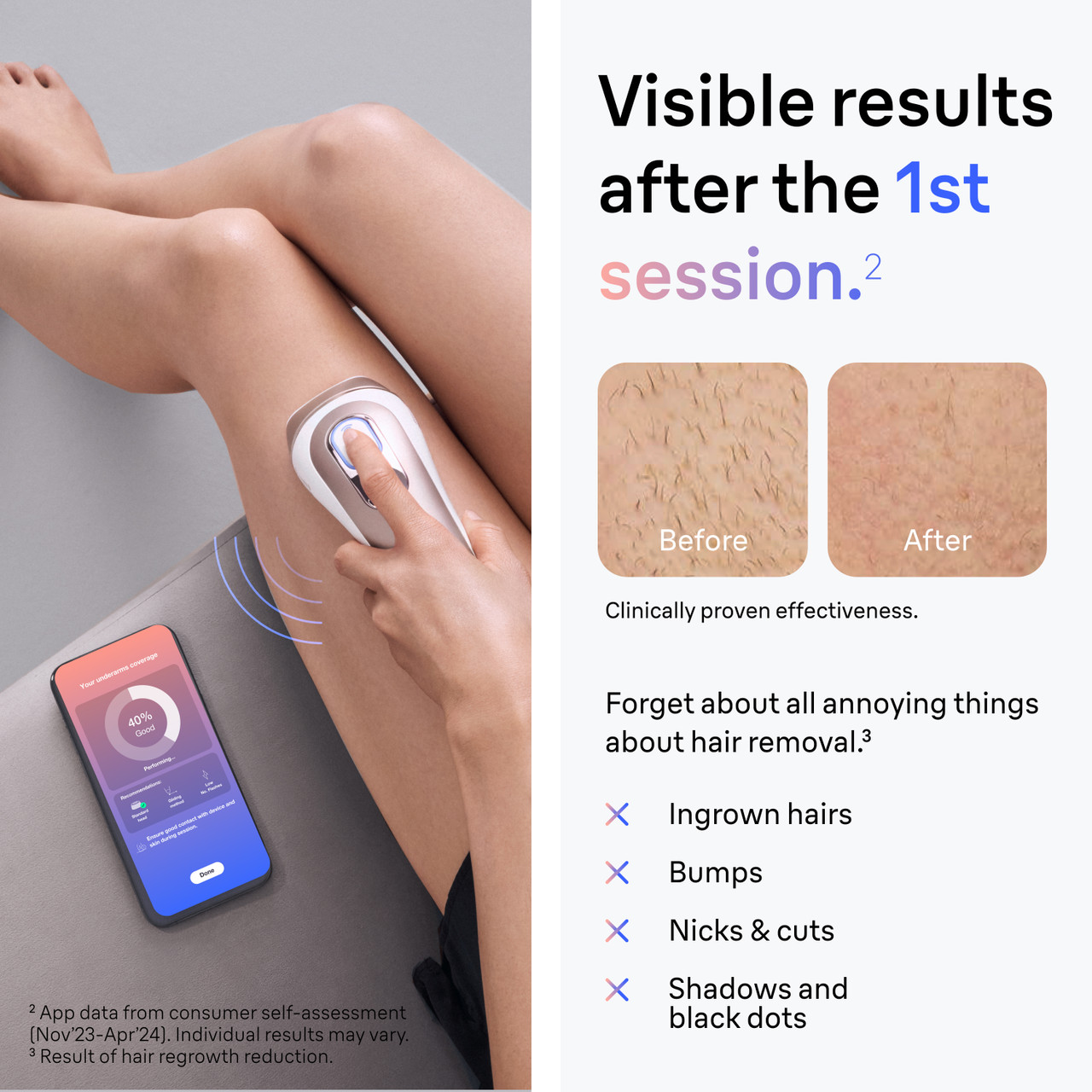 ブラウン Skin i expert Pro7　プレミアムモデル　PL7243 Braun Skin i·expert Smart IPL: Laser Hair Removal, PL7243| Braun