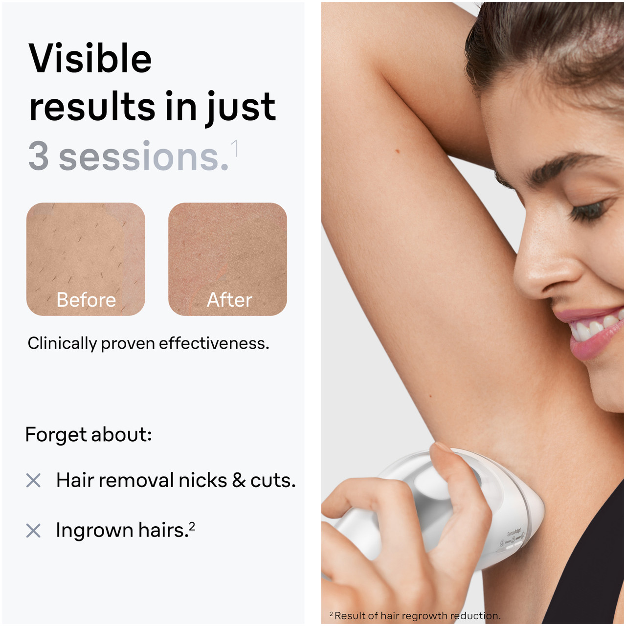 Brun Ipl Braun Smart IPL, Silk·expert Pro 3: At Home Alternative to Laser Hair ...