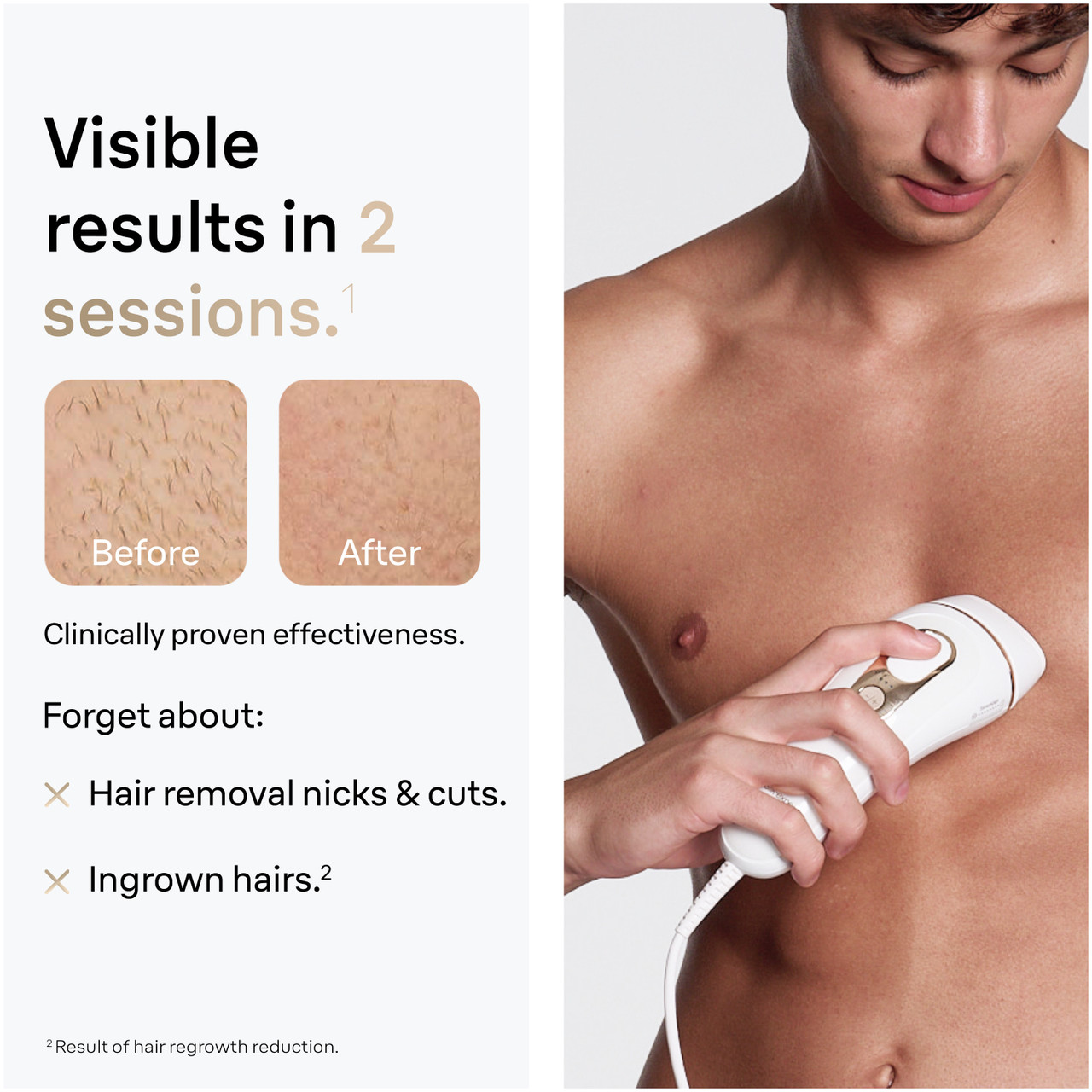 Braun Silk Expert Pro 5: At Home Alternative to Laser Hair