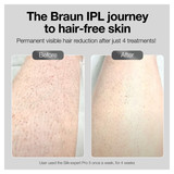 Braun Silk·expert Pro 3 IPL: Alternative to Laser Hair Removal with 3 Caps and Suede Pouch, PL3221