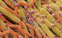 Soil bacteria under a microscope
