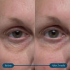 Elemis pro-collageen vitaliteit oogcrème 15ml