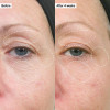 The Inkey List Bio-Active Ceramide Repairing and Plumping Moisturiser Before/After