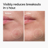The Ordinary Sulfur 10% Powder-to-Cream Concentrate 5g 3 The Ordinary Sulfur 10% Powder-to-Cream Concentrate 5g 3