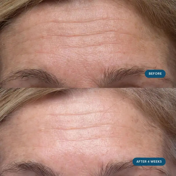 Elemis Pro-Collagen Morning Matrix 50ml Before/After