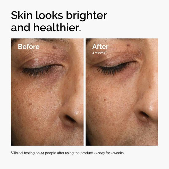 The Ordinary Multi-Antioxidant Radiance Serum 30ml 2