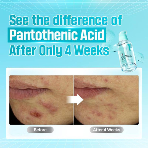 Numbuzin No. 1 Pantothenic B5 Active Soothing Serum 50ml 4