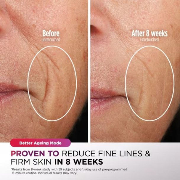 Shark CryoGlow LED Face Mask - Blue Frost 2