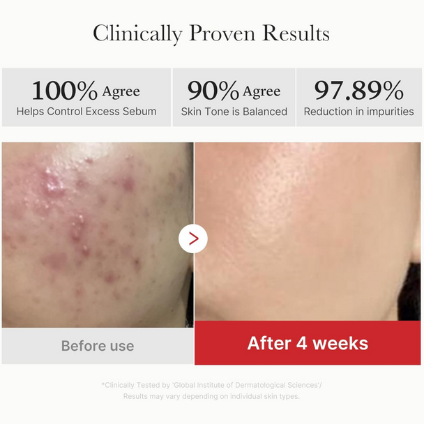 Medicube Red Succinic Acid Peeling Pads x70