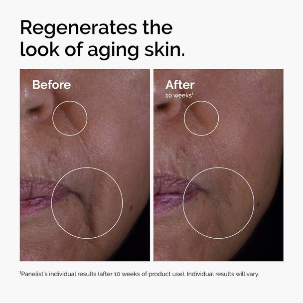 The Ordinary The Renewal Set 4