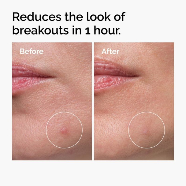 The Ordinary The Target & Treat Set 4