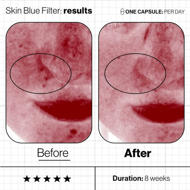  Advanced Nutrition Programme Skin Blue Filter Before/After 3