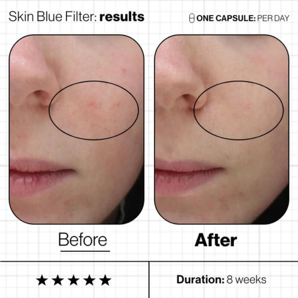  Advanced Nutrition Programme Skin Blue Filter Before/After