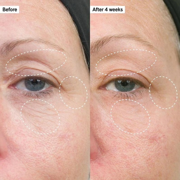 The Inkey List Bio-Active Ceramide Repairing and Plumping Moisturiser Before/After