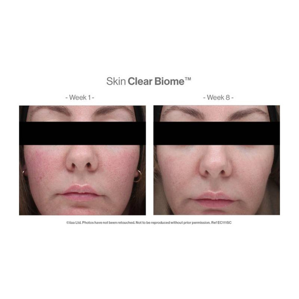 Advanced Nutrition Programme Skin Clear Biome 60 Capsules 2