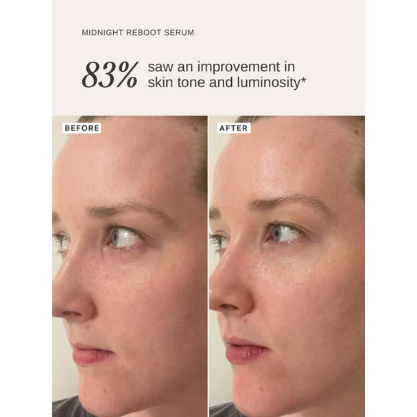  Alpha-H Midnight Reboot Serum 50ml 3