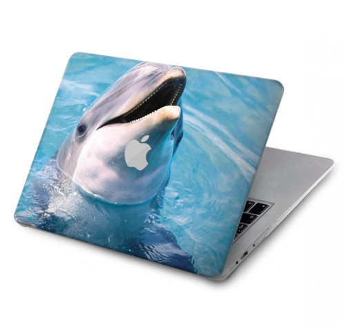 W1291 Dolphin Hülle Schutzhülle Taschen für MacBook Pro 14 M1,M2,M3 (2021,2023) - A2442, A2779, A2992, A2918