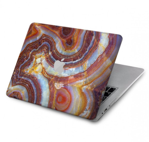 W3034 Colored Marble Texture Printed Hülle Schutzhülle Taschen für MacBook Pro 14 M1,M2,M3 (2021,2023) - A2442, A2779, A2992, A2918