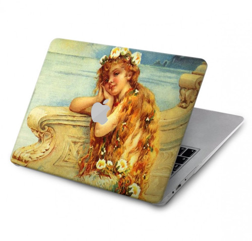 W3184 Little Mermaid Painting Hülle Schutzhülle Taschen für MacBook Pro 14 M1,M2,M3 (2021,2023) - A2442, A2779, A2992, A2918