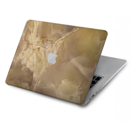 W3240 Yellow Marble Stone Hülle Schutzhülle Taschen für MacBook Pro 14 M1,M2,M3 (2021,2023) - A2442, A2779, A2992, A2918