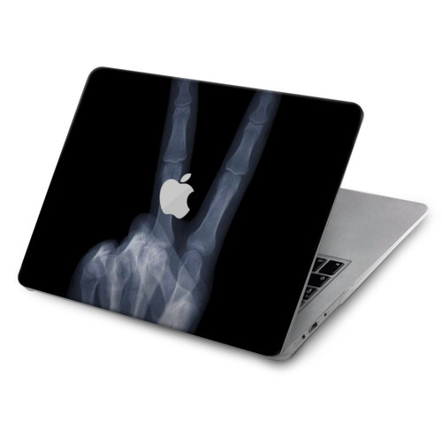 W3101 X-ray Peace Sign Fingers Hülle Schutzhülle Taschen für MacBook Air 15″ (2023,2024) - A2941, A3114
