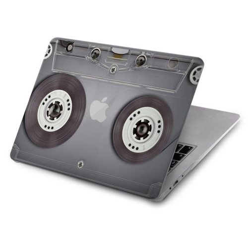 W3159 Cassette Tape Hülle Schutzhülle Taschen für MacBook Air 15″ (2023,2024) - A2941, A3114