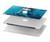 W0899 Mermaid Hülle Schutzhülle Taschen für MacBook Pro 14 M1,M2,M3 (2021,2023) - A2442, A2779, A2992, A2918